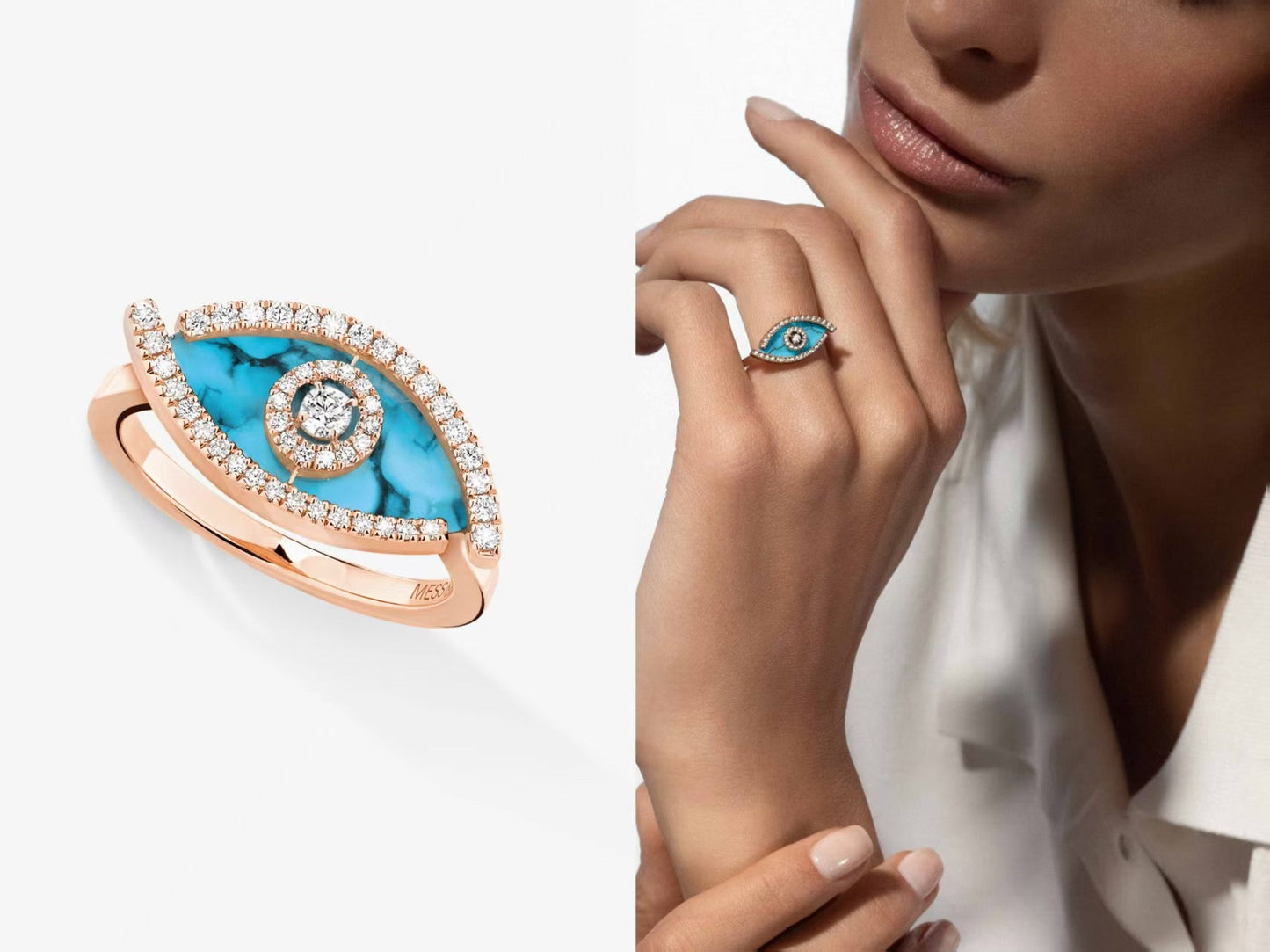 [Eternal Jewelry]Lucky Eye Malachite Ring